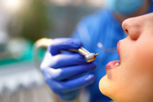 Dental Inlays and Onlays in Port Hadlock Irondale, WA